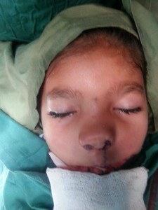 Manisha nach der erste Operation